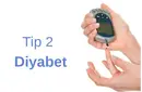 Diyabet Tip 2 Belirtileri ve Tedavisi Diyabet Tip 2 Belirtileri ve Tedavisi